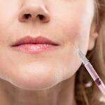 Everything You Wanted to Know About Wrinkle Relaxing Injections