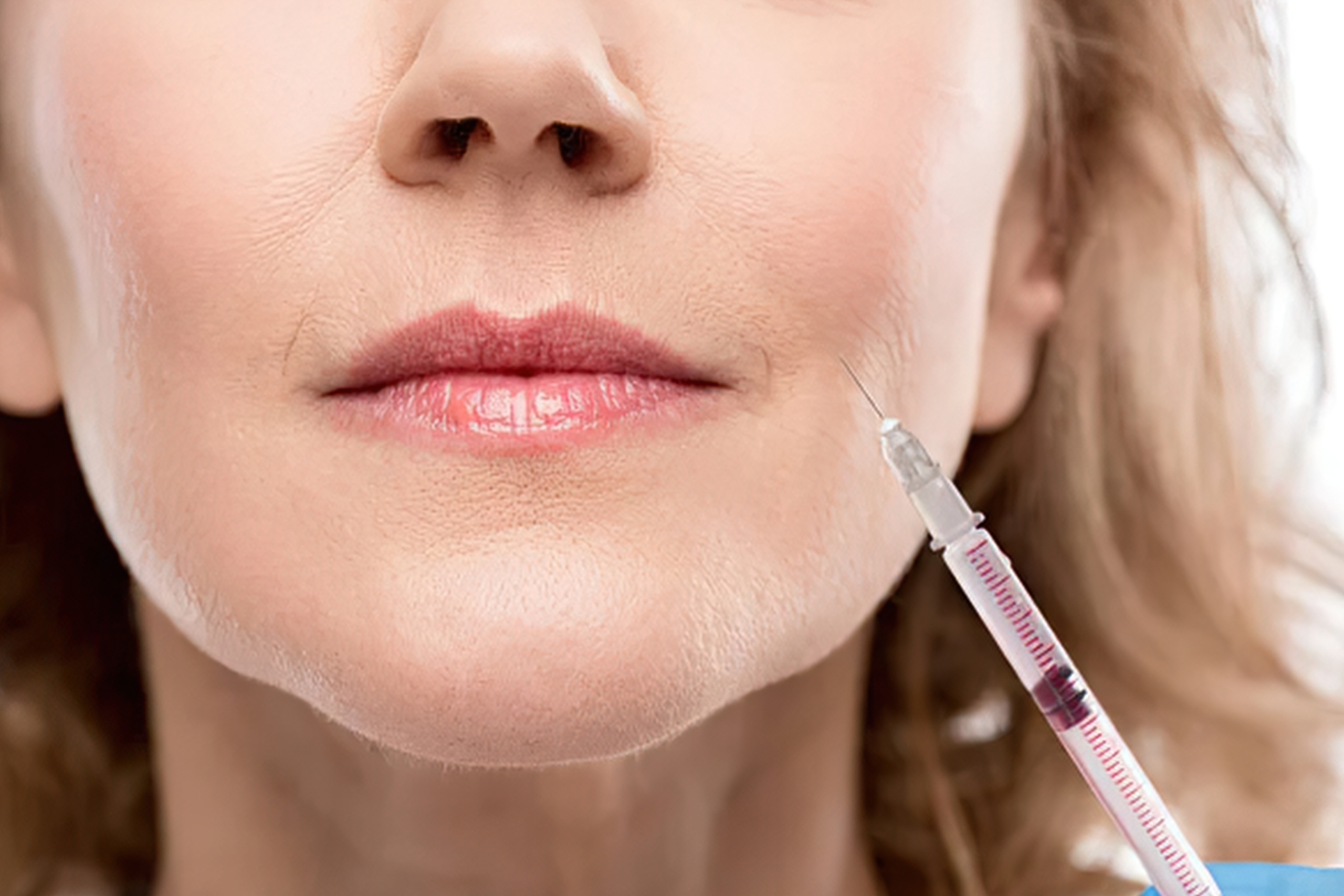 Everything You Wanted To Know About Wrinkle Relaxing Injections